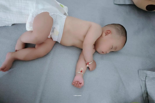 沈阳宝宝头上长痱子